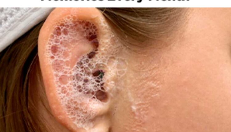 preventing hearing loss