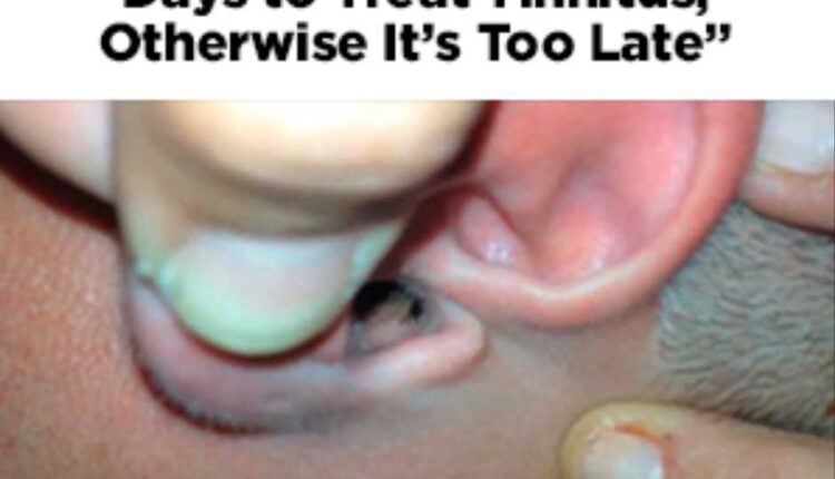 treatment to tinnitus causes